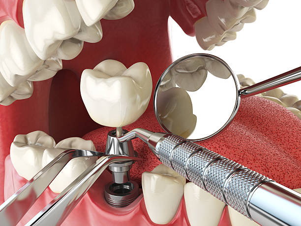 Best Emergency Treatment for Toothache in Forest Hills, TN